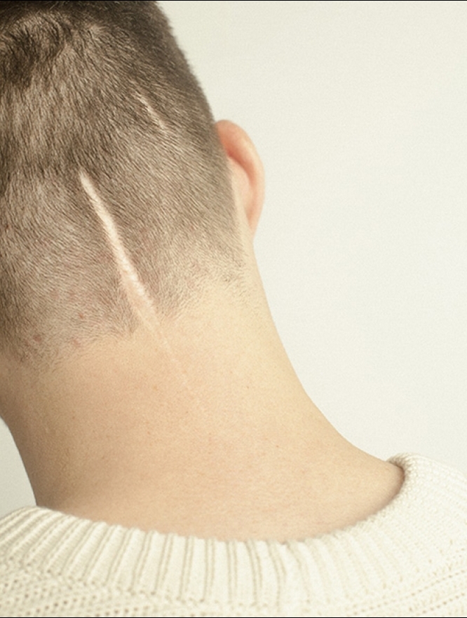 Scars Small Thumbnail